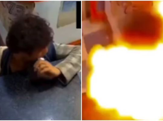  A horrifying incident caught on camera: Putting a smartphone battery in your mouth proved costly! The explosion was caused by a thermal runaway; a viral video on social media has raised concerns.