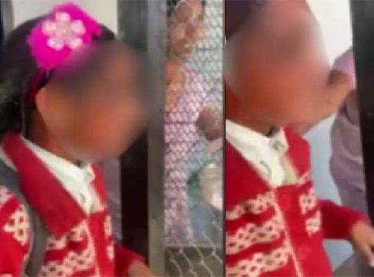 Sensational attack: A 6-year-old girl was stopped on the pretext of asking for directions. The accused threw acid on her face and fled. Police are investigating CCTV footage.