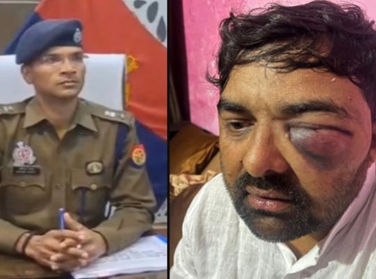 Farmer leaders in Meerut level sensational allegations against the police! "Shoot me first, then stage an encounter with them"&mdash;claims of alleged assault ranging from the SSP's office to the police station.